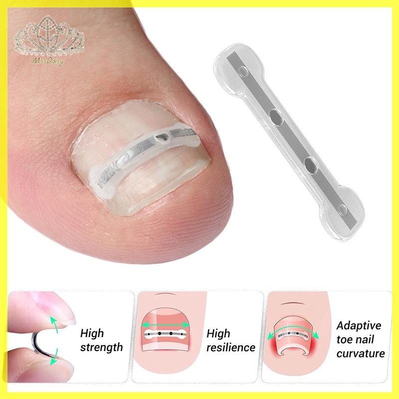 คุดเล็บเท้าแก้ไขเครื่องมือคุด Toe Nail Treatment Elastic Patch สติกเกอร์ Straightening คลิปรั้ง Pedicure เครื่องมือ TH