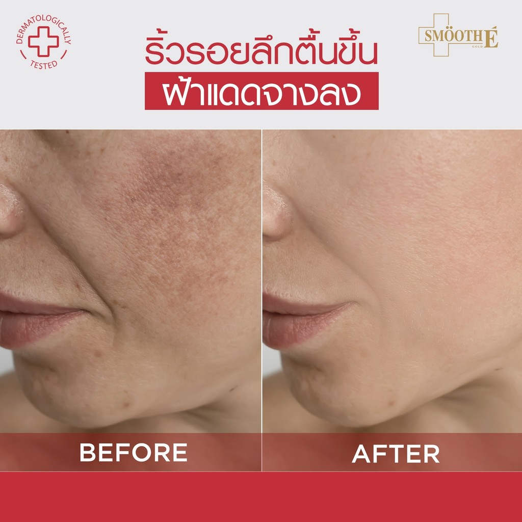 [แพ็คสุดคุ้ม 4 ฟรี 1] Smooth E 24k Glow Booster Wrinkle Repaire Supreme Serum 30 ml. x4 Free Dark Spot 30 ml.