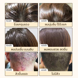 FAYANKOUแชมพูน้ำมันมะพร้าว แชมพูสูตรอ่อนโยน ลดรังแค ควบคุมความมัน บำรุงรากผมให้แข็งแรง ผมนุ่มฟู500ml