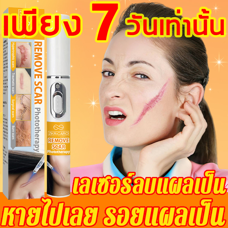 ✨เทคโนโลยีเยอรมัน✨ ปากกาลบแผลเป็น เลเซอร์ ทําแผลเป็นจาง เห็นผลใน 2 สัปดาห์! ซ่อมผิวระดับเซลล์บอกลาปัญหาผิวแผลเป็น