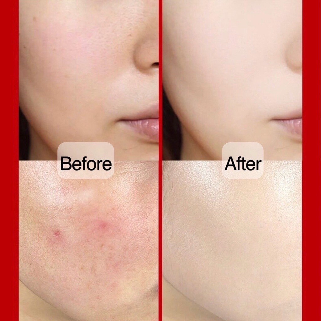 Lameila บีบีครีม คุชชั่น ให้ความชุ่มชื้น เรียบเนียน เพื่อผิวสวยอย่างเป็นธรรมชาติ 15 กรัม คุชชั่นแดง - รูปที่ 4