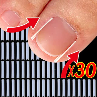 10/20/30 ชิ้นคุด Toenail Corrector - แผ่นรองหลอดรูปตัว C ยืดหยุ่น - รักษาเล็บนิ้วเท้า คลิปยืดร่องที่มองไม่เห็น