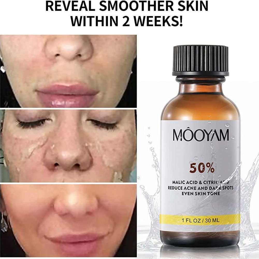 สินค้าspottTCA 50% Chemical Peel Tca Peel Acid Skin Superforce Peel(30ML)