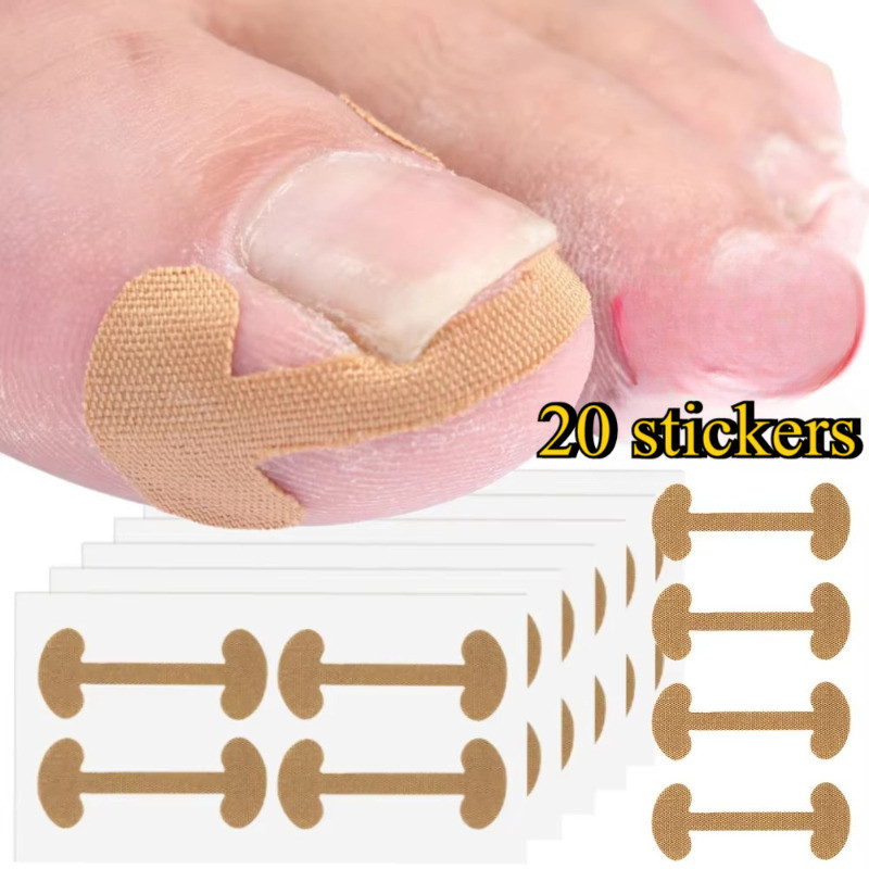 สติกเกอร์แก้ไขเล็บเท้าคุด-เครื่องมือทําเล็บเท้ากาวตนเอง-สติกเกอร์รักษา โรคพาโรนีเชีย-สติกเกอร์ดูแลยางยืด-ตัวแก้ไขรักษาเล็บ-เล็บ การดูแล ทันตกรรมจัดฟัน ปะ