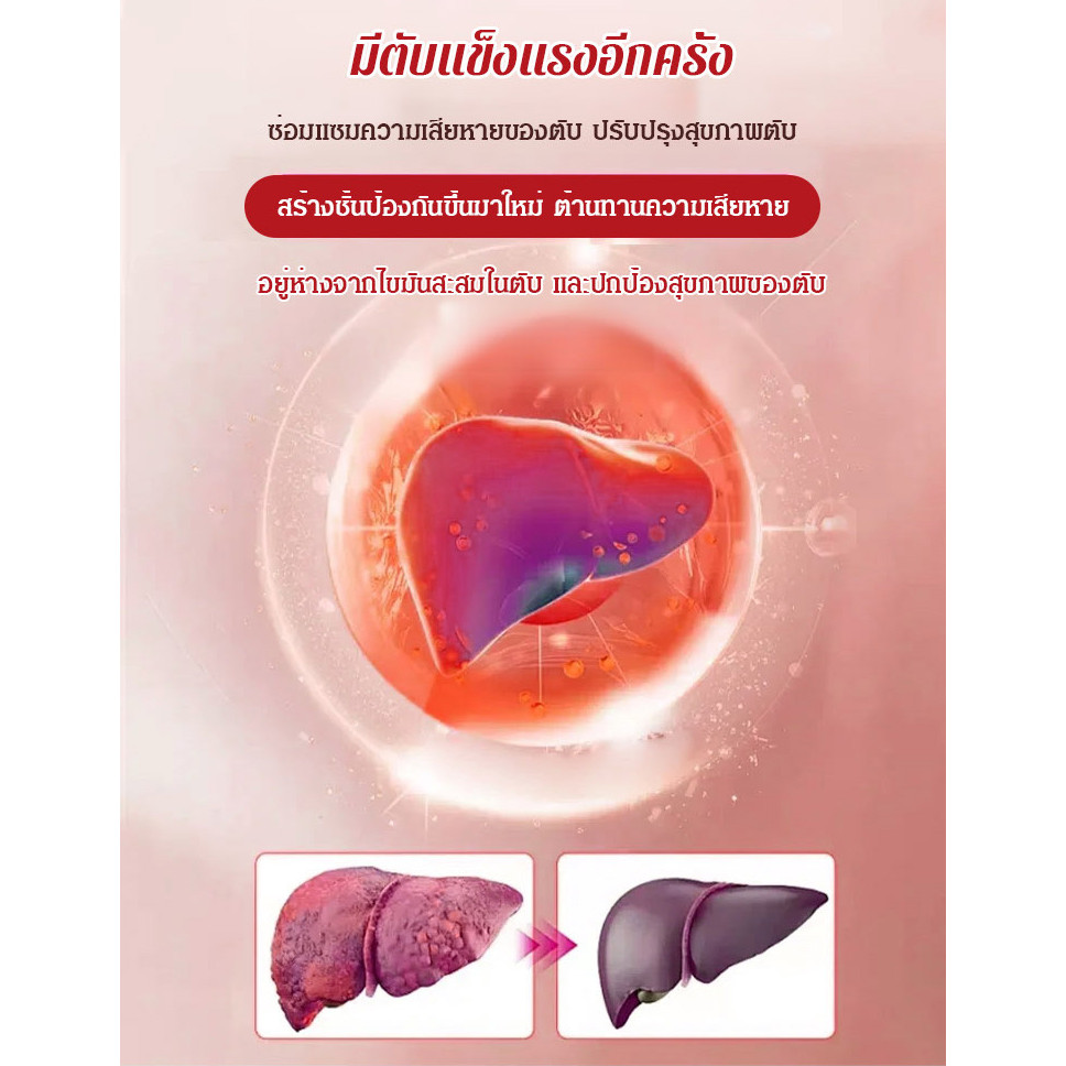 ซื้อ 2 แถม 1 แพทช์บำรุงตับที่มี thistle นมและสารสกัดจากส้ม แพทช์บำรุงตับที่มีประสิทธิภาพ แพทช์ moxibustion ร้อน Mugwort ราคา ถูกที่สุด ดีลบีเคเค แกลเลอรีภาพที่ 8