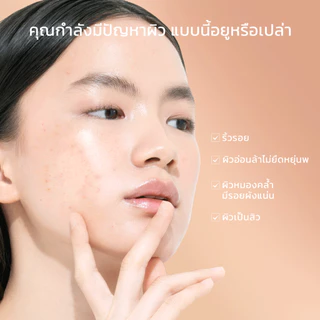 SKINTIFIC- Retinol Skin Renewal MoisturizerL Anti Aging เรตินอล ครีมทาหน้า มอยเจอไรเซอร์ มอยเจอร์ไรเซอร์เรตินอล เพื่อผิว