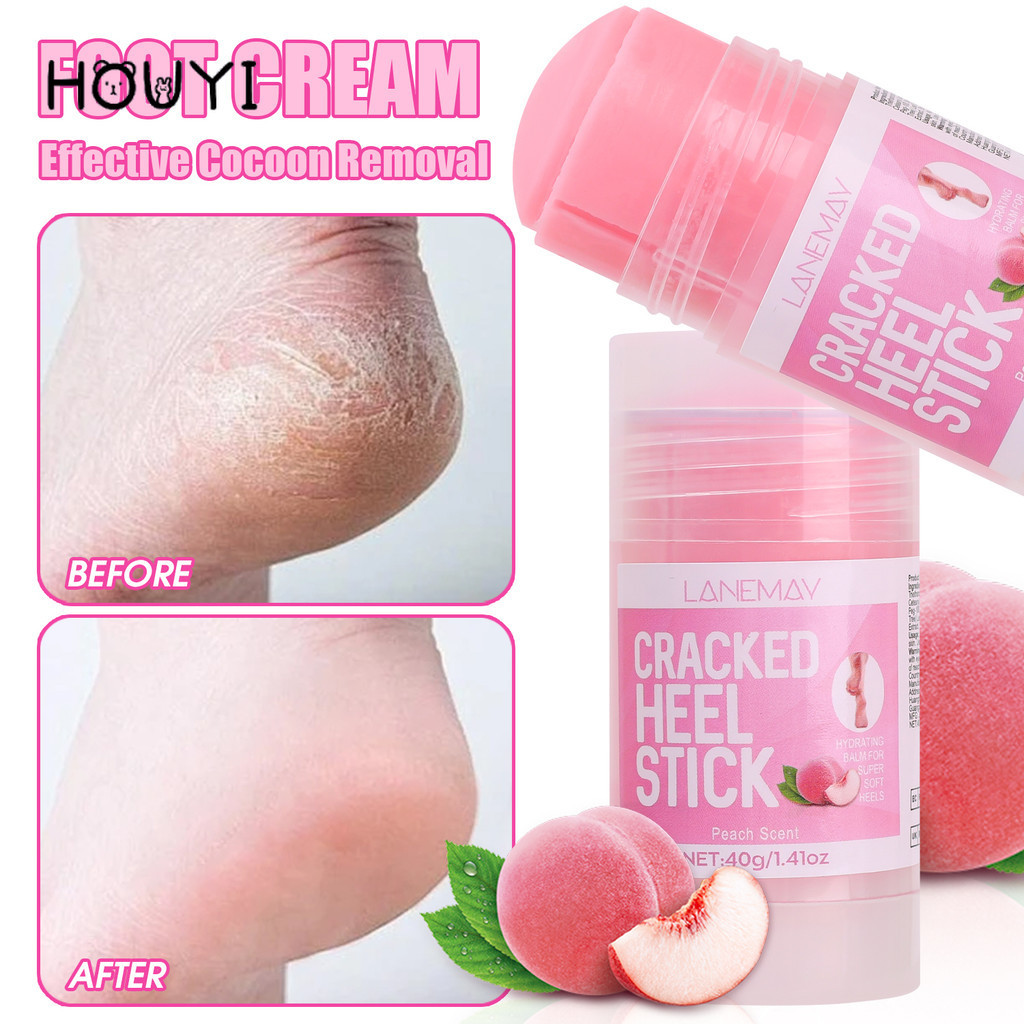 Ultra-hydrating Anti-Drying Crack Foot Care Cream - Removal Dead Skin Hand Foot Body Care Tool