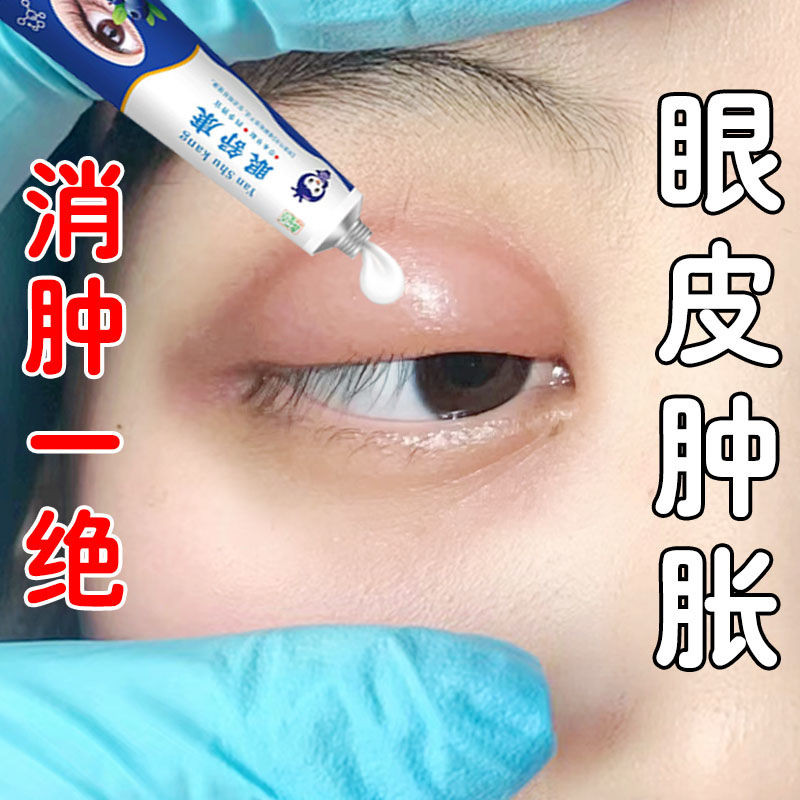 เปลือกตาสีแดง Edema กําจัดบวมเปลือกตาบวมบวมบวม Staying Up Late Night Edema Fine เส้นเปลือกตาสีแดง Ed