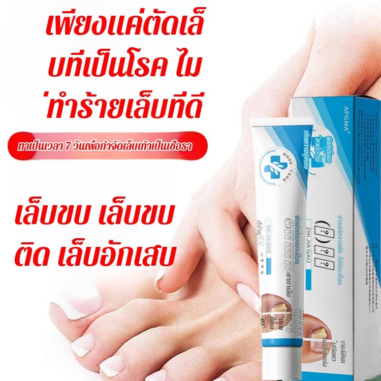 1/2/3ชิ้น ป้องกันการ เกิดซ้ํา สีเทา ยาทาเล็บ ครีมดูแล ยาทาเล็บสีเทา