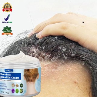 OBAT KETOMBE PARAH Scalp Itching dan Dandruff Rambut rontok Anti Ketombe cream
