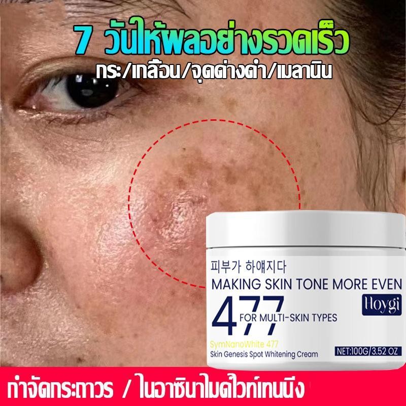 Hoygi South Korea Skincare Moisturizing 477 ครีมทาฝ้า ลดฝ้ากระที่ฝังลึก จุดด่างดำ กระ กระจ่างใสผิว ค
