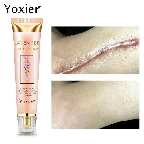 Wholesale YOXIER Scar Removal Cream Lavender Scar Repair Cream