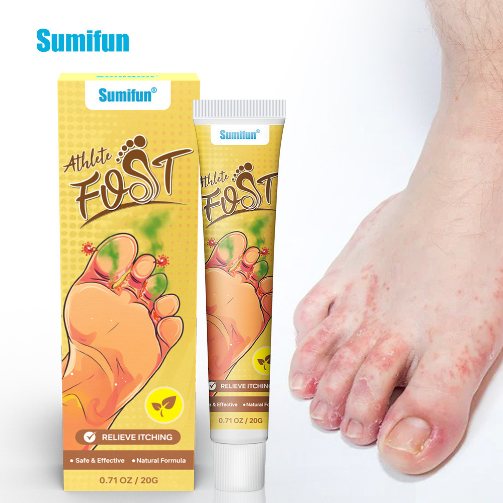 พร้อมสต็อก Fast Shipping sumifun Ointment Medicine Foot Cream Foot Cream Gentle Peeling Foot Odor Fo