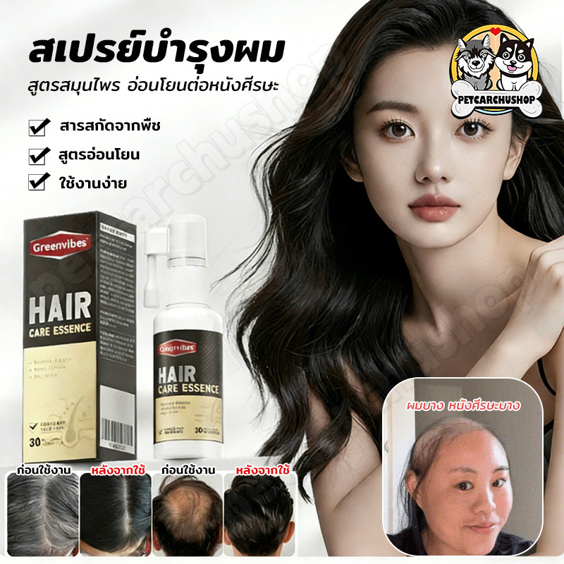 สเปรย์บำรุงเส้นผม เสริมสร้างผมให้ยาวเร็ว แก้ปัญหาผมร่วง ผมบาง ผมดำเป็นเงางามสุขภาพดี