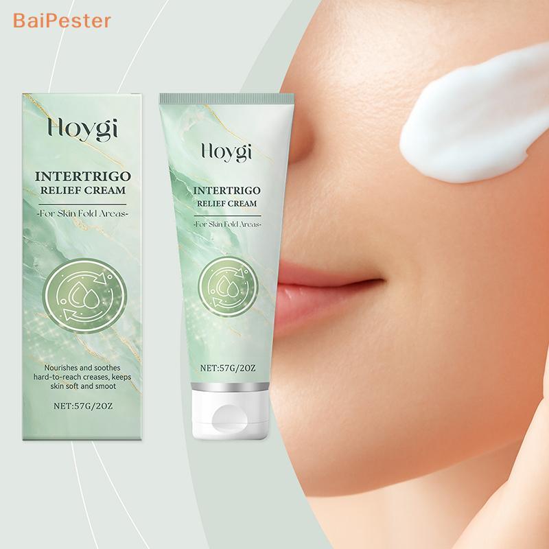 [BaiPester] Interdrigo Cream – Skin Fold Care & Chafing Support Cream With Zinc Oxide & Undecylenic 