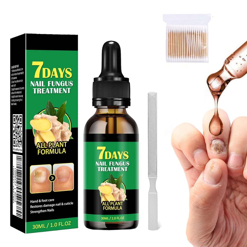 Hola Honey 7 Days Ginger Nail, Ginger Nail Serum 7 Days, 7 Days Nail Treatment For Nail Carem, Nail 
