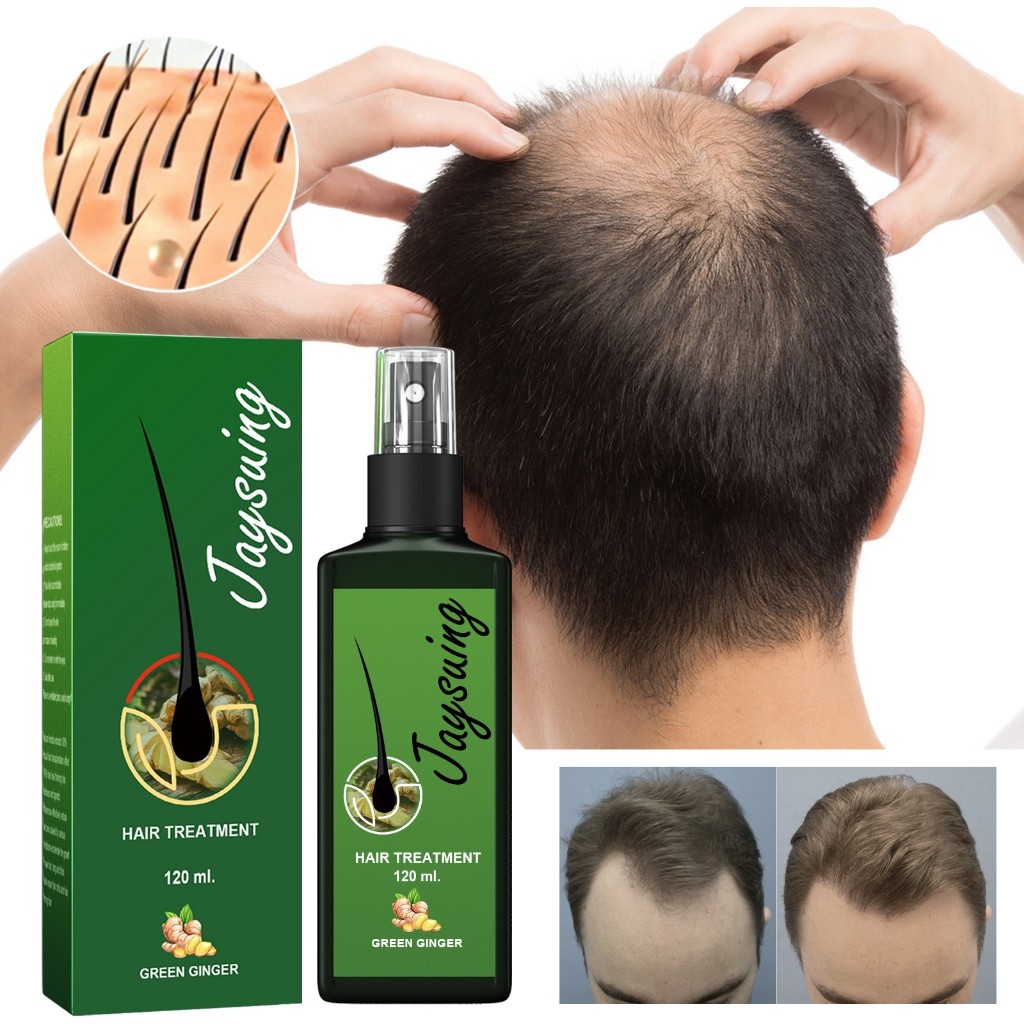 Jaysuing 120ml สเปรย์ปลูกผม เชรั่มปลูกผม นีโอแฮร์ของแท้ เซรั่มปลูกผม น้ำยาปลูกผม บอกลาหัวล้าน