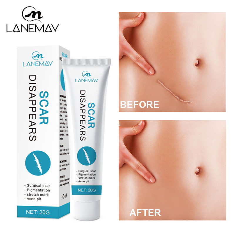 Scar Cream Ointment Cold Compress Gel Light Scar Cream China Three Years อื่นๆ Effects Water A041706