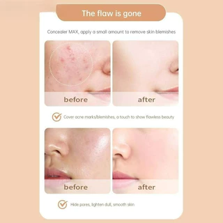 Svmy เครื่องสําอางคอนซีลเลอร์ เนื้อครีม สําหรับซ่อมแซมผิวหน้า รอบดวงตา และสิว 4 สี