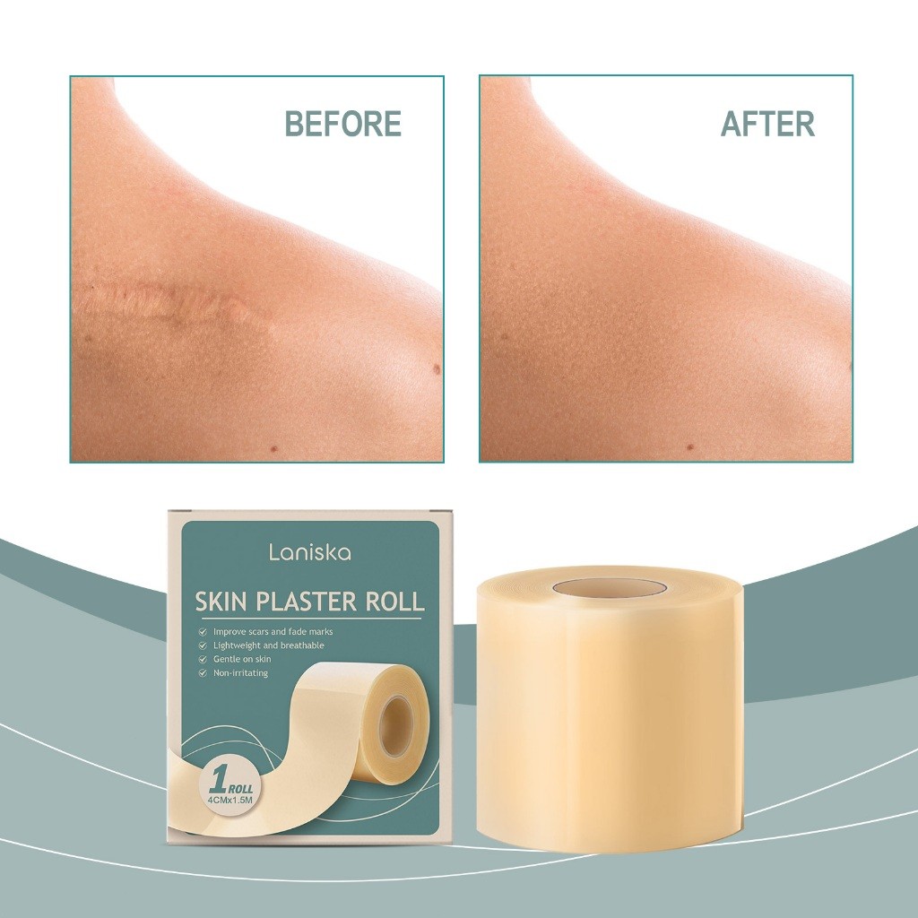 Laniska แผ่นแผลเป็นซิลิโคน Silicone Scar Tape 4cm*150cm เทปซิลิโคนสำหรับรอยแผลเป็น, แผ่นซิลิโคนสำหรับรอยแผลเป็น