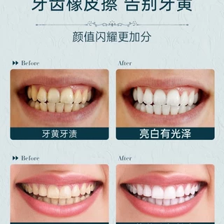 [สต๊อกพร้อม] UK Imported Perry Dr. Perry Fresh Brightening Toothpaste แชทส่วนตัว WJG
