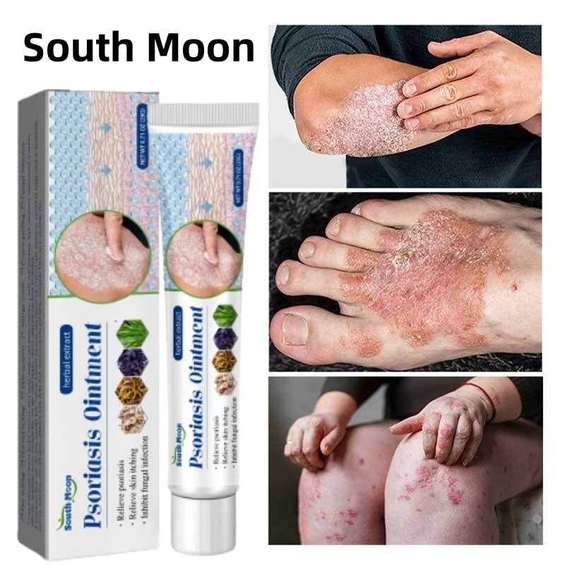 【ซื้อ 1 แถม 1】ครีมลดอาการคัน ทาแก้คัน ผิวหนังทากากเกลื้อน สารสกัดจากพืชใช้ได้ทั้งตัวบอกลาผิวคันได้ง่ายๆ