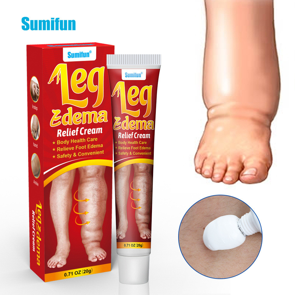 พร้อมสต็อก Fast Shipping sumifun ครีมยา Edema ครีมขาลอย Edema กล้ามเนื้อ Edema บวม Care ครีม K101622