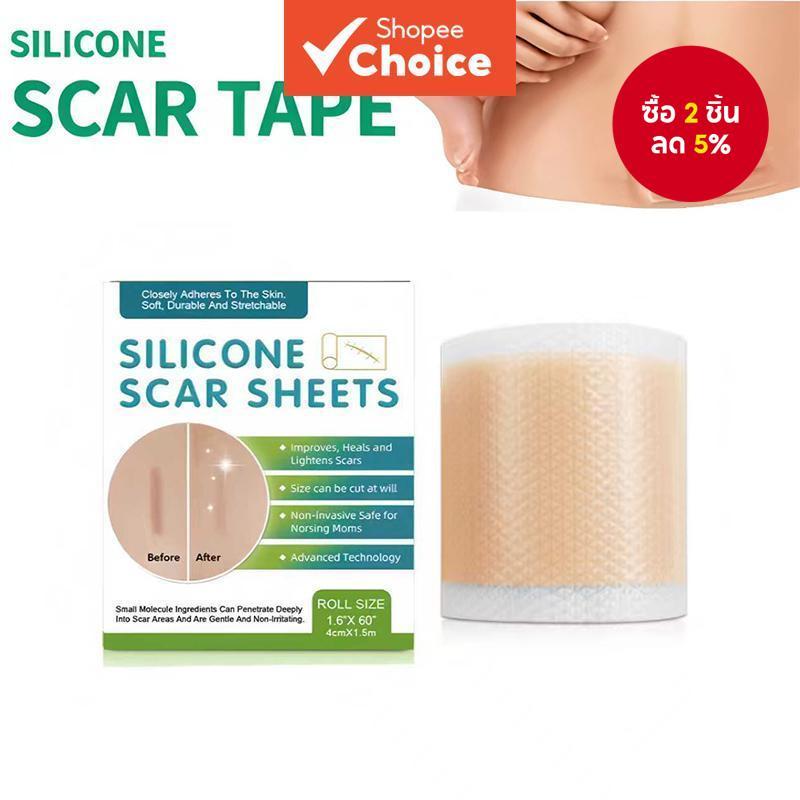 แผ่นซิลิโคนลดรอยแผลเป็นแบบใช้ซ้ําได้ ม้วน 4x150 ซม. - เทปลดรอยแผลเป็นที่ปรับแต่งได้ สําหรับรอยแผลเป็นจากการผ่าตัด คลอดบุตร และคีลอยด์ กันน้ําและก่อให้เกิดอาการแพ้น้อย ติดเองได้