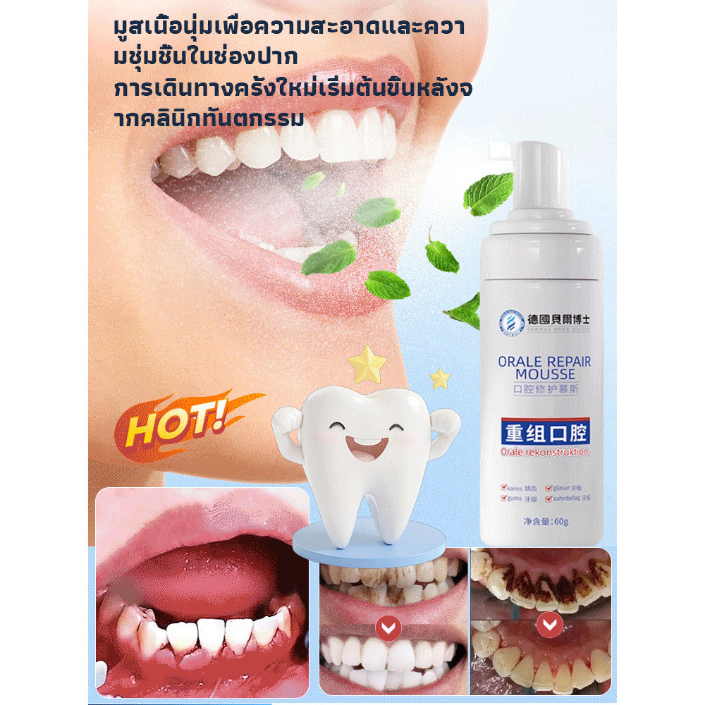 【ผ่านการทดสอบทางการแพทย์】SL มูสฟื้นฟูช่องปากเร่งด่วน รักษาแผลในปาก/มูสสําหรับช่องปาก/สูตรทางการแพทย์ ราคา ถูกที่สุด ดีลบีเคเค แกลเลอรีภาพที่ 3