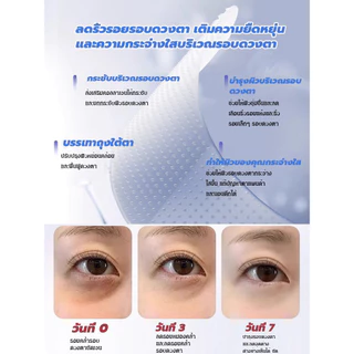 พร้อมส่ง🔥มาส์กตาไมโครนีดเดิลกระชับลดริ้วรอย แผ่นแปะ สำหรับริ้วรอยรอบดวงตา/มาส์กไมโครนีเดิล อายมาร์ค ลดตายับ คืนความไบร์ทให้ใต้ตา ร่องแก้ม หน้าผาก บำรุงผิวพรรณ ลดรอยคล้ำใต้ตา ของใช้สำหรับผู้หญิงทุกวัย