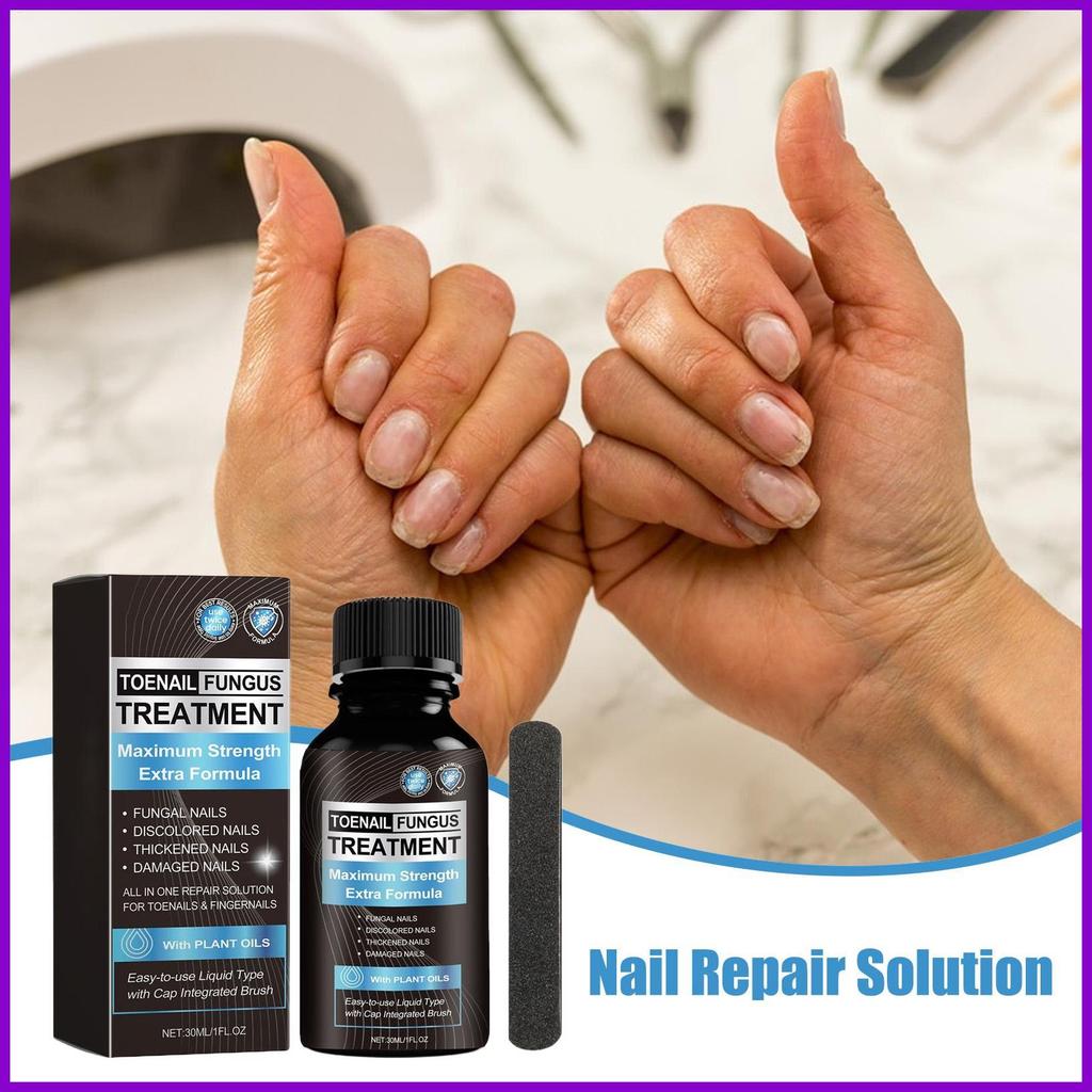 Toe Nail Repair Nail Nourishing Solution 30ml Nourishing Handle Repair Solution สําหรับอาบน้ําทุกวัน