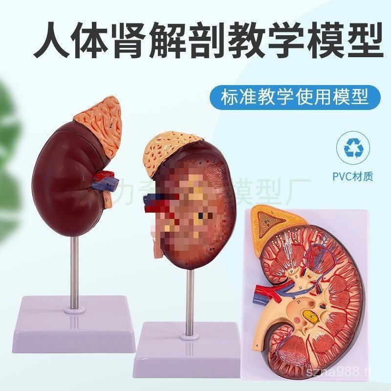 Amplification สอน Kidney Double Natural Model 2 Kidney Upper Kidney Anatomy Human Anatomy HKSN