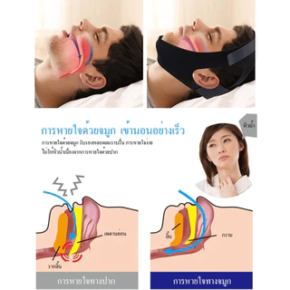 สายรัดคางป้องกันคาง อุปกรณ์ป้ออนกรนและพูดคุยในการนอนหลับ