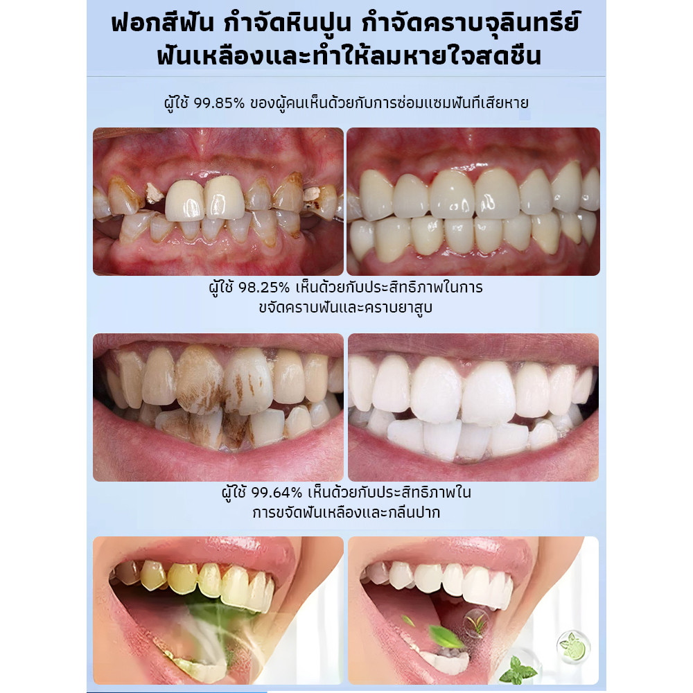 【ผ่านการทดสอบทางการแพทย์】SL มูสฟื้นฟูช่องปากเร่งด่วน รักษาแผลในปาก/มูสสําหรับช่องปาก/สูตรทางการแพทย์ ราคา ถูกที่สุด ดีลบีเคเค แกลเลอรีภาพที่ 5