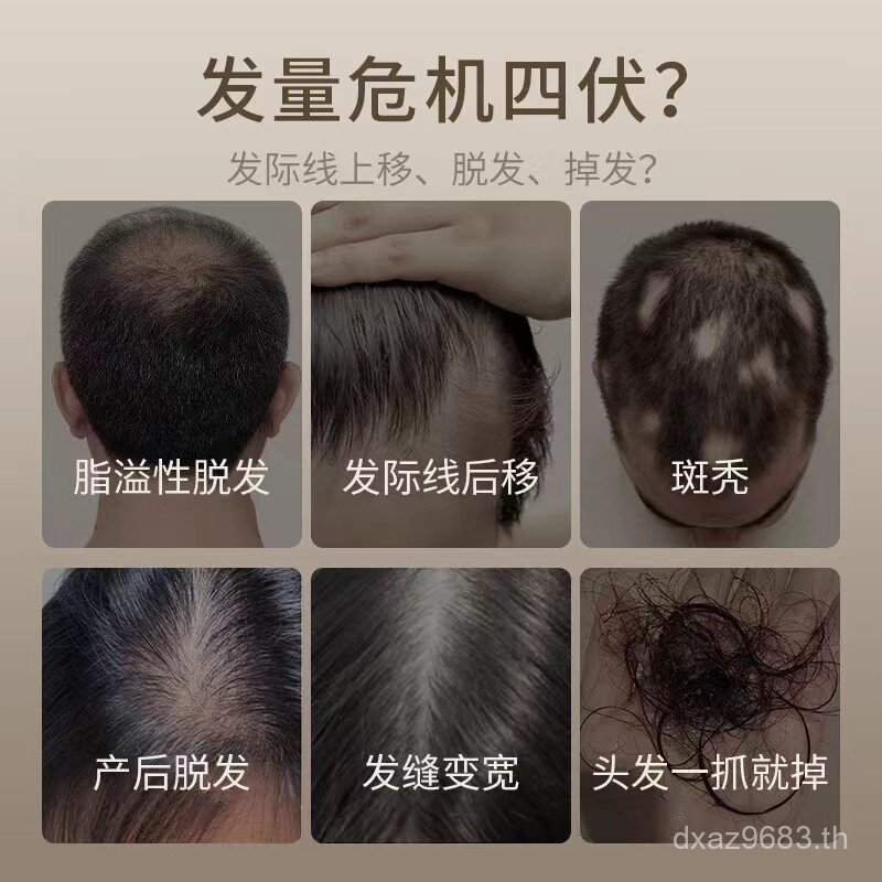 Essence Oil Control Anti-Dandruff Soothing Hair Tonic Hair Nourishing Shop Water Luminous Scalp Hair