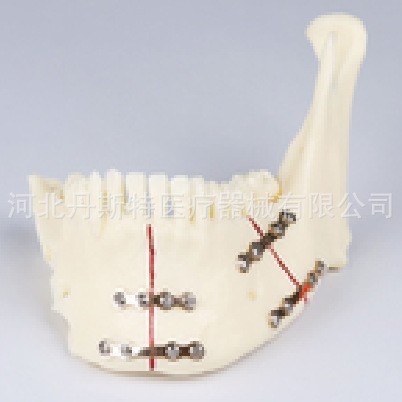 Spot Goods#Mandibula0402hw