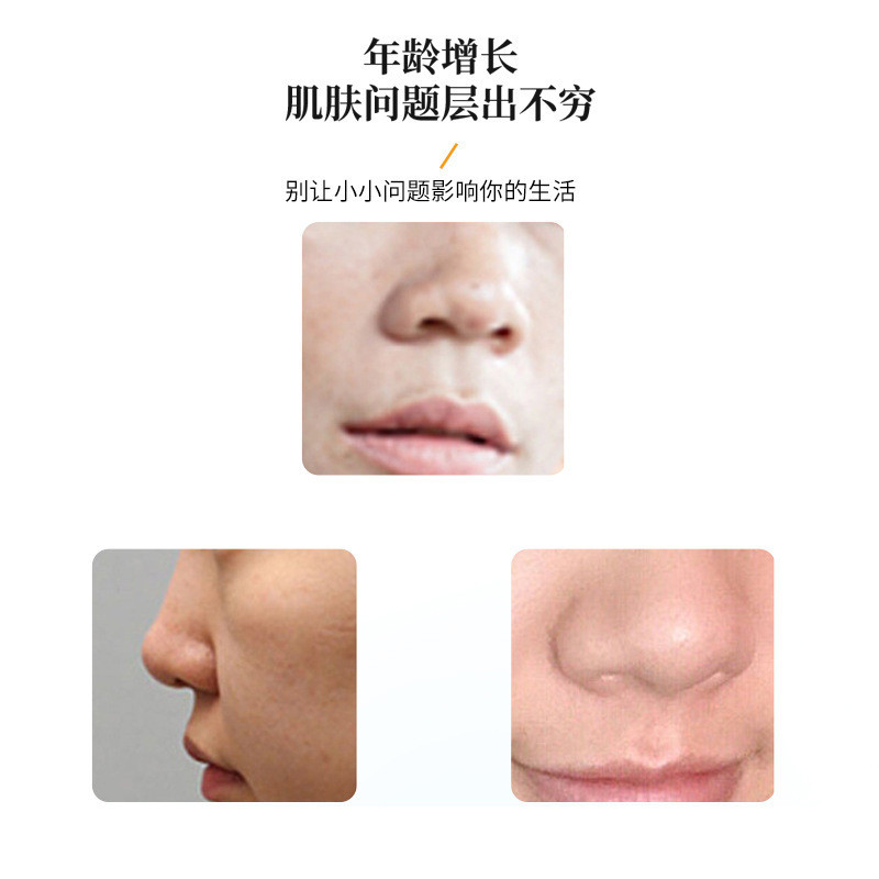 ️ BBS สะพานจมูกรากจมูกซี่โครงชีวภาพจมูกคอลลาเจนไม่มีคืน Freeze-Dried Moisturizing Antioxidant