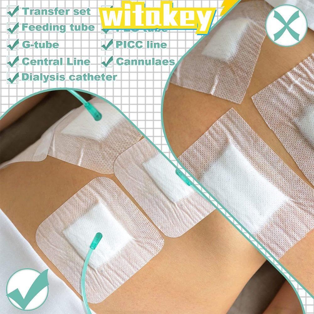 WITAKEY 10pcs Chest Catheter Cover, Wound Bandage อุปกรณ์ไตเทียม Feeding Tube Pad, ทนทาน Gtube อุปกร