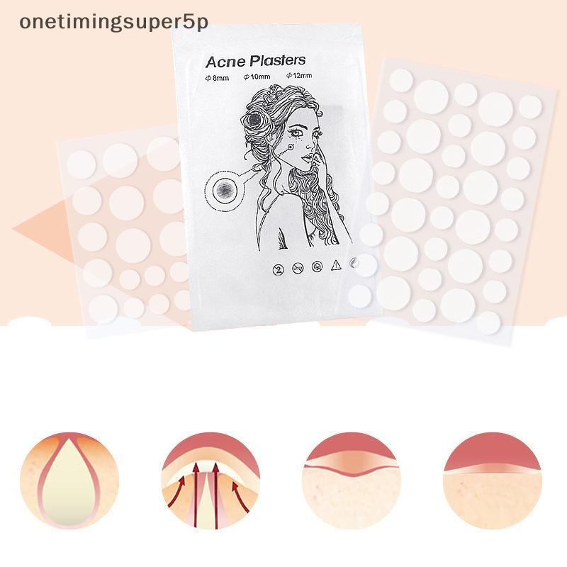 Onetimingsuper5p 36 Hydrocolloid Pimple Patch กันน้ําสิว Spot Treatment แผ่นคอนซีลเลอร์ PER
