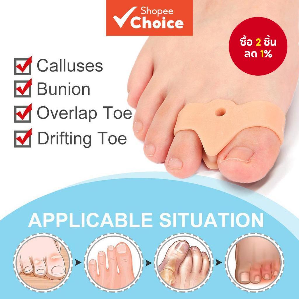 2 ชิ้น Bunion Corrector เครื่องแยกนิ้วเท้าเหมาะสําหรับการบรรเทาตาปลาและนิ้วเท้าที่ทับซ้อนกัน