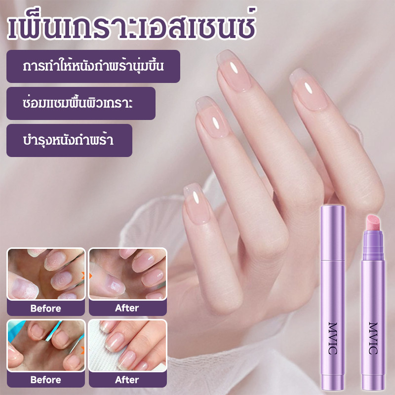 ปากกาบํารุงเล็บ 3-in-1 บํารุงเล็บเปราะ บํารุงเล็บแข็ง