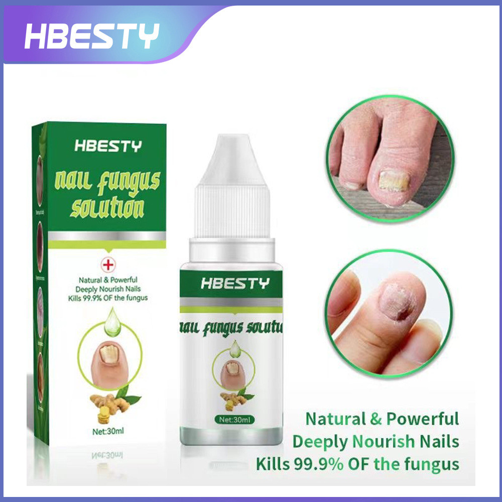 HBESTY โลชั่นซ่อมแซมเล็บ TK Herbal Plant Nail Cleansing Bright Potassium Grey Potassium Foot Care Lo