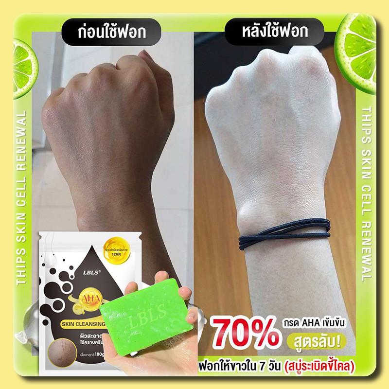 สบู่ LBLS สบู่ฟอกผิวขาว ก้อนใหม่สีเขียวเข้ม เน้นเรื่องผิว ขาวใส(ส่งเร็ว )