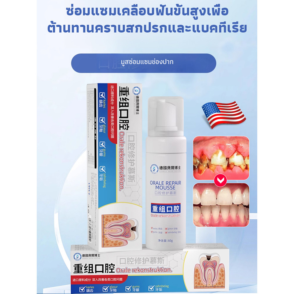 【ผ่านการทดสอบทางการแพทย์】SL มูสฟื้นฟูช่องปากเร่งด่วน รักษาแผลในปาก/มูสสําหรับช่องปาก/สูตรทางการแพทย์ ราคา ถูกที่สุด ดีลบีเคเค แกลเลอรีภาพที่ 2
