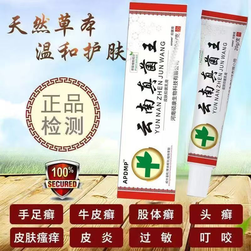 New Product#[Yunnan Fungus King]Special-effect topical cream for skin itching, for use on the whole 