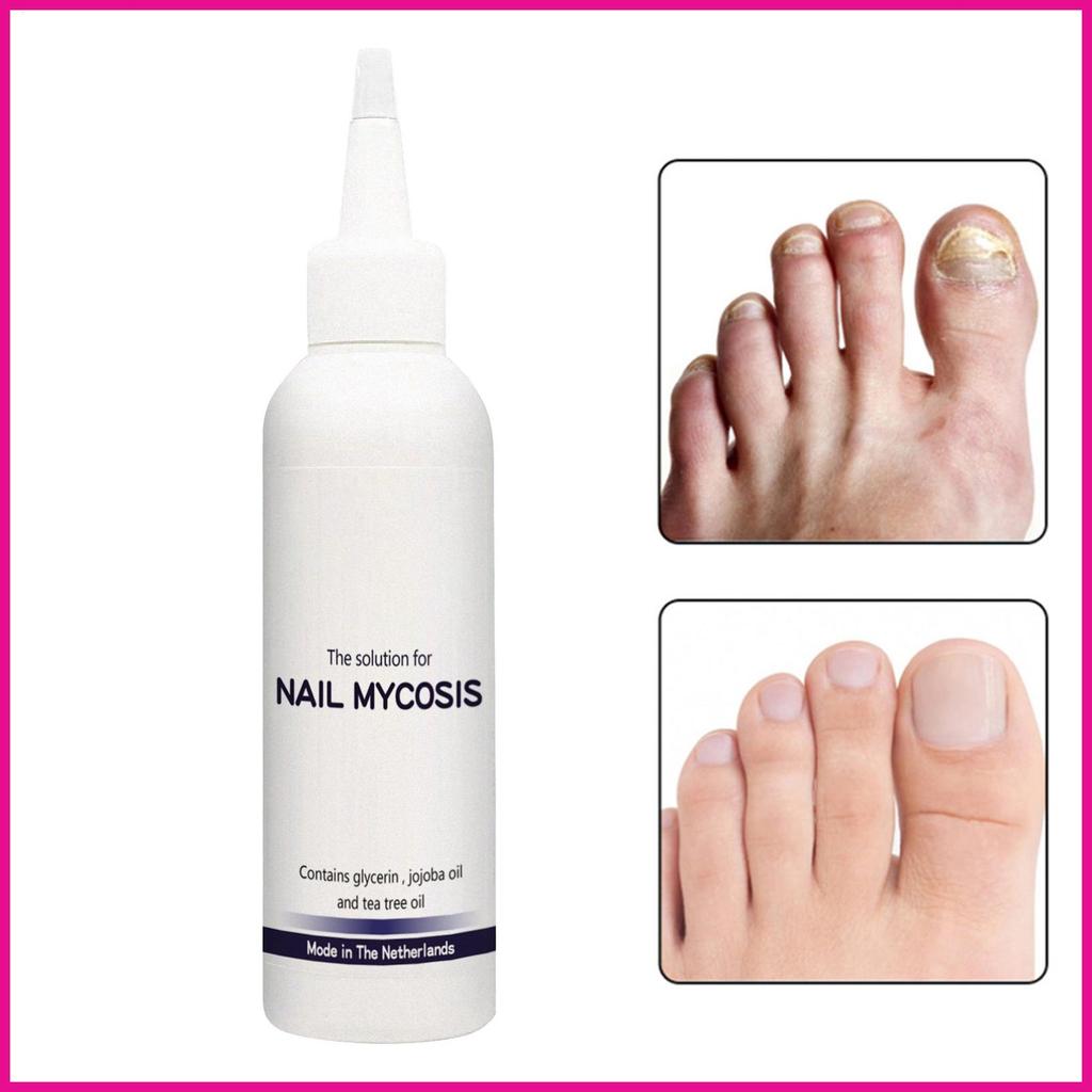 ซ่อมแซมเล็บ 75ml Strengthening Solution Toenail Softener สําหรับผู้หญิงผู้ชายการบํารุงรักษาทุกวันโพส