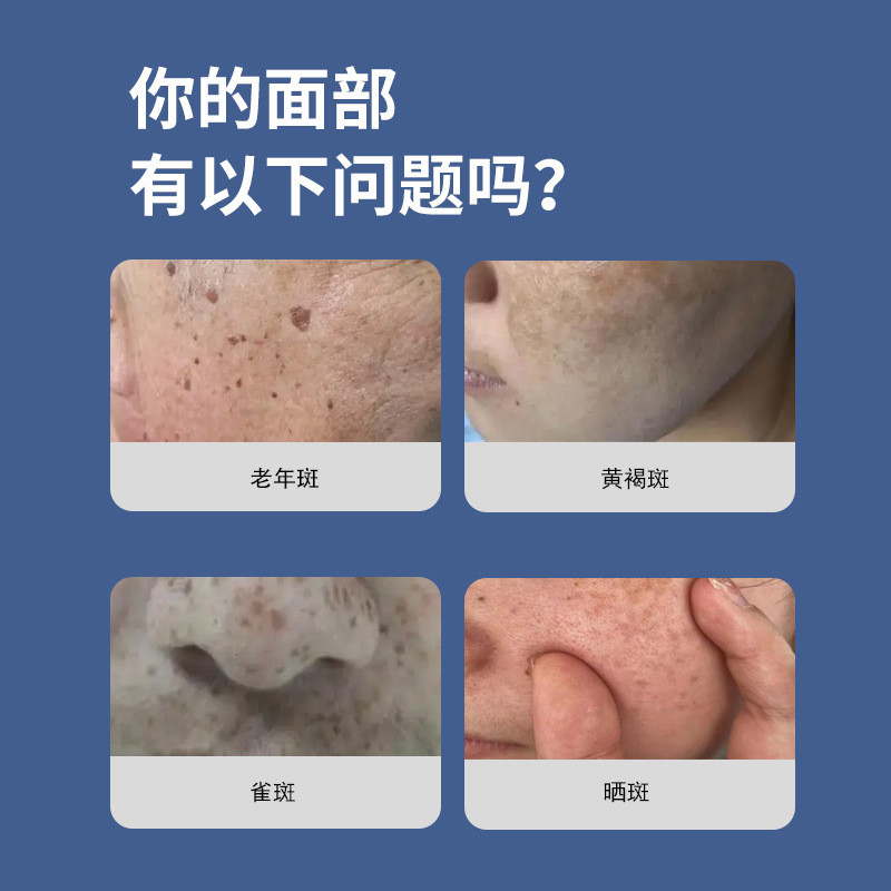 Jing Ransheng Old Spots Skin Spot Removal Cream Even Skin Color Cream Color Spots Suppression Cream 