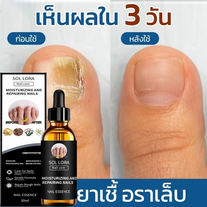 【COD】 น้ำยาฟื้นฟูเล็บ สารสกัดสมุนไพรเพื่อรักษาเชื้อราเสริมความแข็งแรงปกป้องเล็บเปราะ