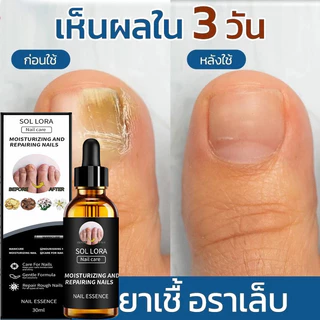 【COD】 น้ำยาฟื้นฟูเล็บ สารสกัดสมุนไพรเพื่อรักษาเชื้อราเสริมความแข็งแรงปกป้องเล็บเปราะ