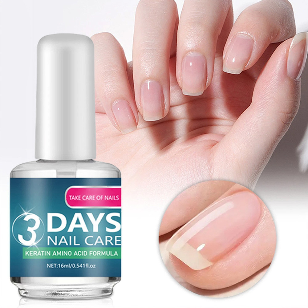 Nail Repair Liquid Treatment for thickened nails and fungal nail infections Onychomycosis Repair Sol